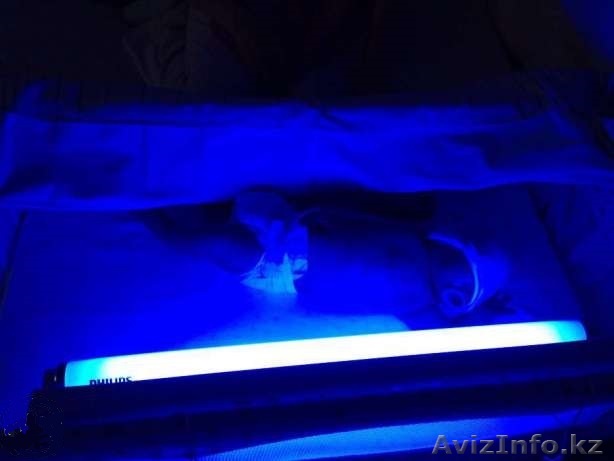 Фотолампа для лечения желтушки - Изображение #1, Объявление #1509732