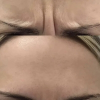 Косметолог Губки как у Анджелины Джоли! - Изображение #5, Объявление #1722409