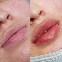 Косметолог Губки как у Анджелины Джоли! - Изображение #3, Объявление #1722409