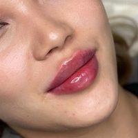 Косметолог Губки как у Анджелины Джоли! - Изображение #1, Объявление #1722409