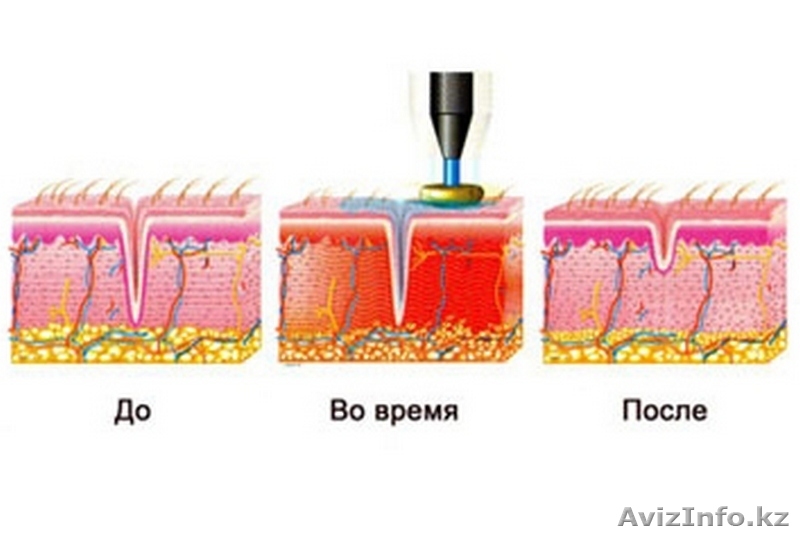 Косметологическое омоложение ! - Изображение #2, Объявление #1144336