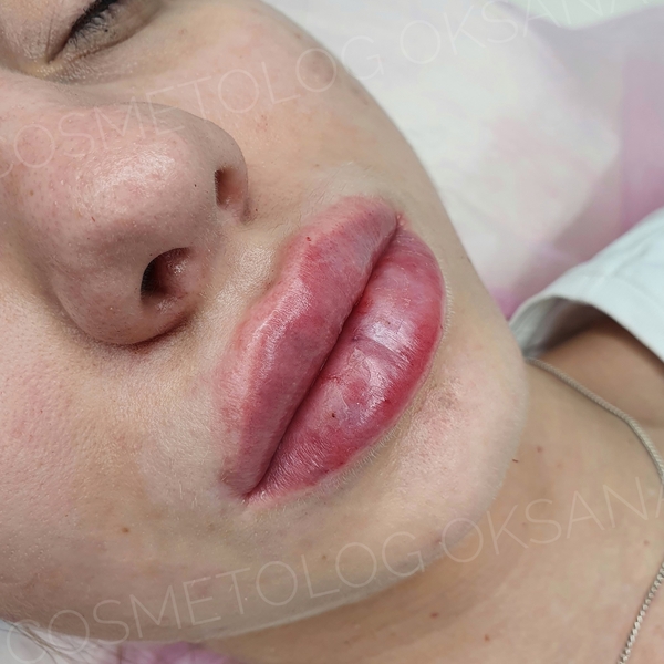 Косметолог Губки как у Анджелины Джоли! - Изображение #2, Объявление #1722409