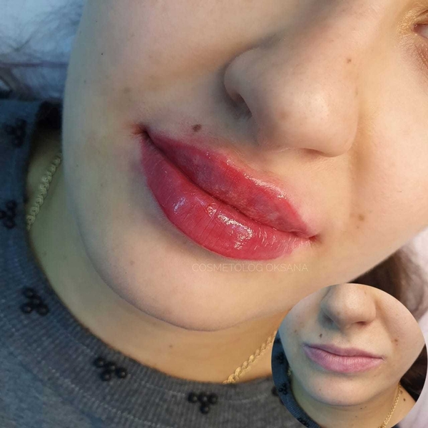 Косметолог Губки как у Анджелины Джоли! - Изображение #6, Объявление #1722409