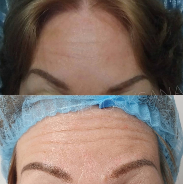 Косметолог Губки как у Анджелины Джоли! - Изображение #4, Объявление #1722409