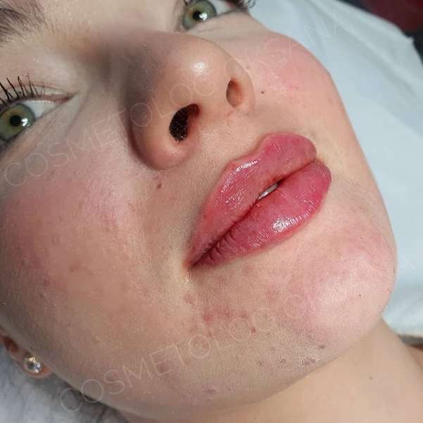 Косметолог Губки как у Анджелины Джоли! - Изображение #7, Объявление #1722409